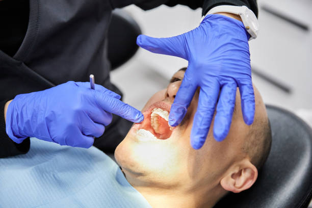 Best Dentist for Tooth Abscess  in Sublette, KS